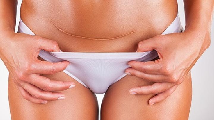 宫颈糜烂对女性的危害都有哪些呢?