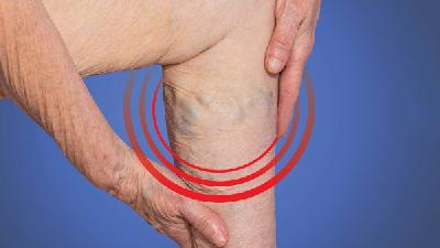 治疗腿部静脉曲张的办法有哪些?