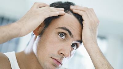 脂溢性脱发的症状有什么
