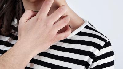 痤疮有哪些症状表现的呢?