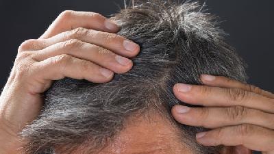 人为导致脱发的原因是什么呢?