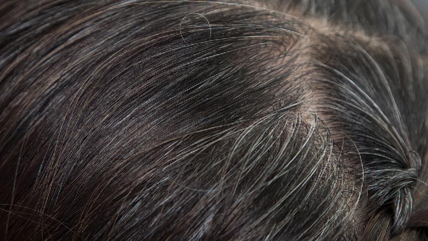 輕松預防脫發(fā)的五步按摩方法