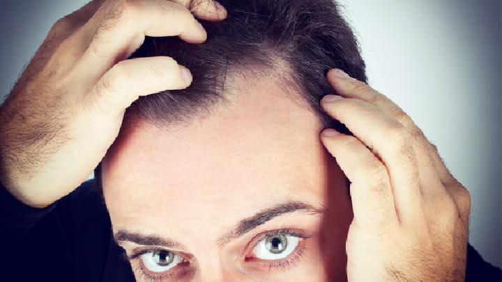 男性脱发的原因及治疗