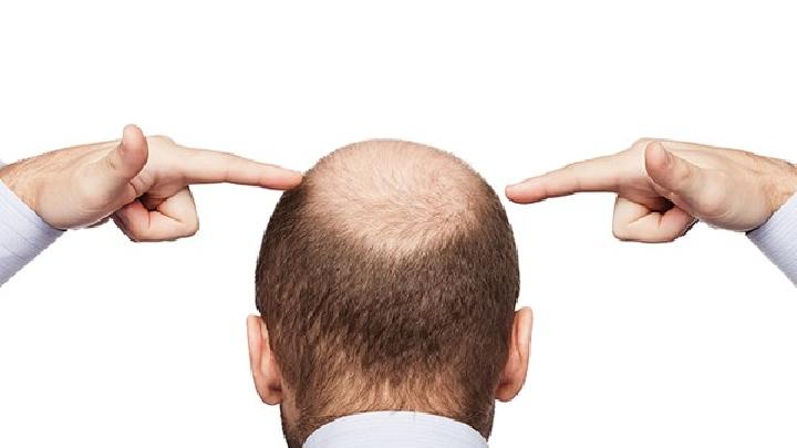 有效预防脱发的五大方法