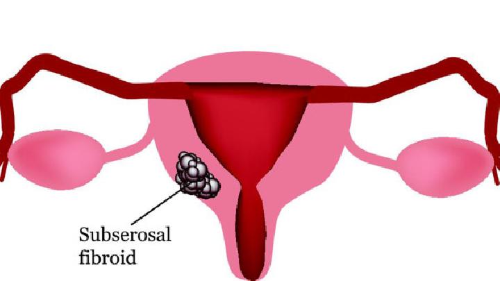 解析多发性子宫肌瘤的症状有哪些
