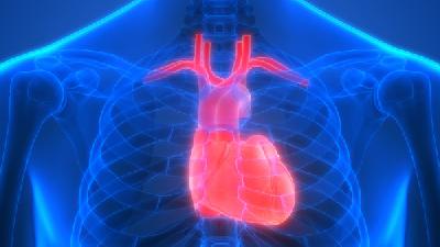 心肌梗塞型冠心病是怎样的呢