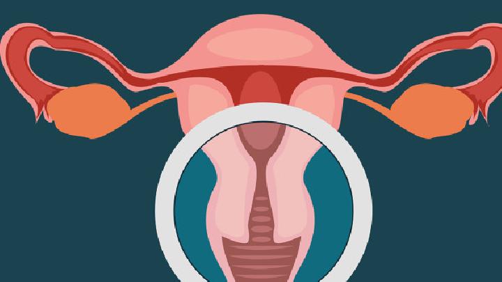 引发卵巢囊肿原因是有哪些因素