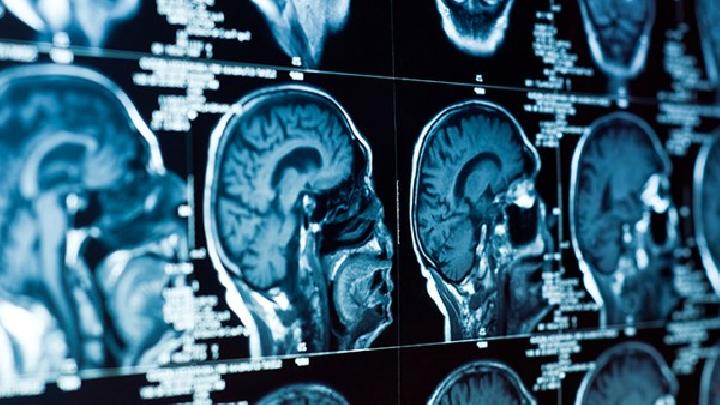 脑萎缩的病因常见的有哪些?