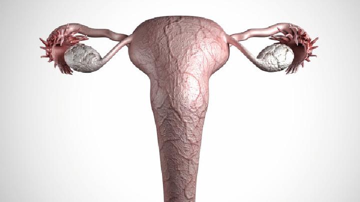 子宫肌瘤临床表现很容易导致女性不孕