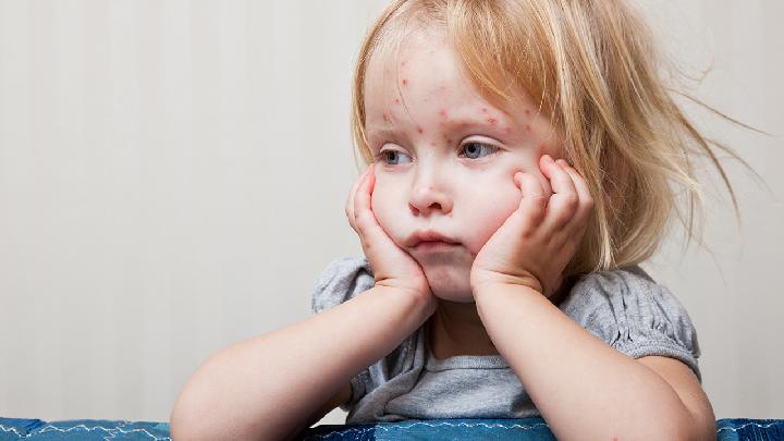 小儿麻痹症的症状会随着病情程度改变