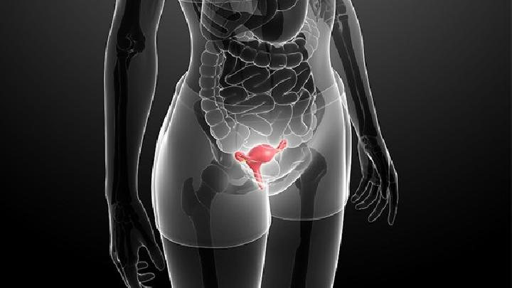 盘点子宫肌瘤有哪些典型的症状?