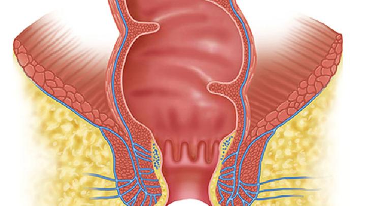 宫颈癌早期症状在子宫颈表面有明显表现