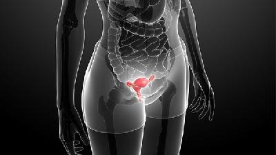 卵巢癌的症状在晚期会出现恶病质现象