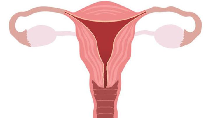 女性如何預(yù)防盆腔炎發(fā)生?