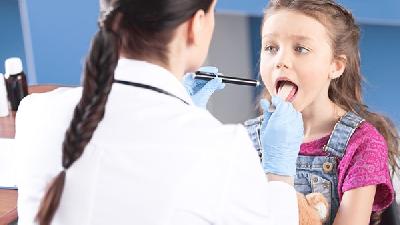 四种常见的咽炎的表现大家需要分开认识