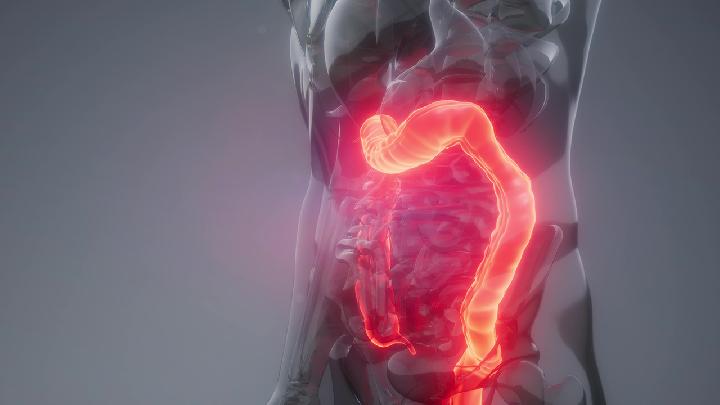 腹胀不适可以考虑下是大肠癌的症状