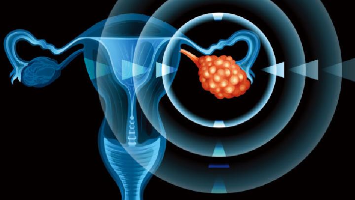内分泌因素可能会是卵巢囊肿的原因