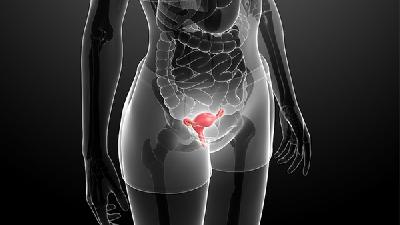 女性卵巢囊腫的癥狀通常是內(nèi)分泌紊亂引起的