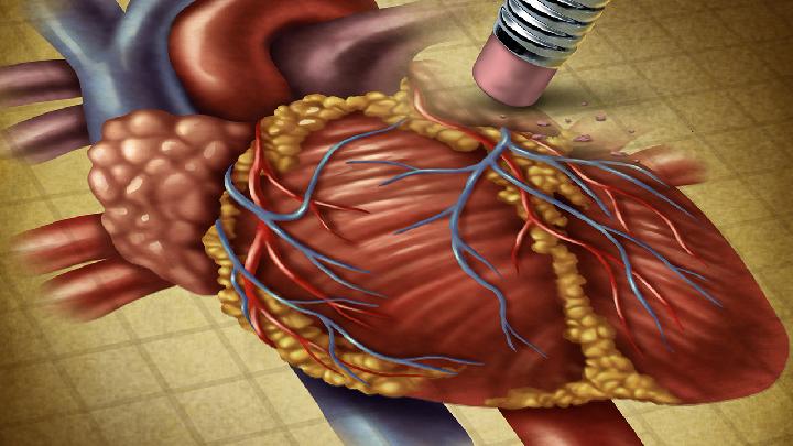 专家为大家解答常见的冠心病的病因