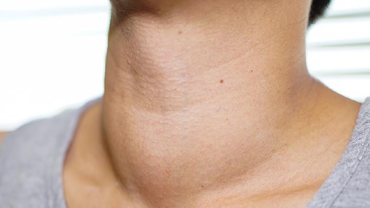 甲减患者很有可能会出现皮肤干燥