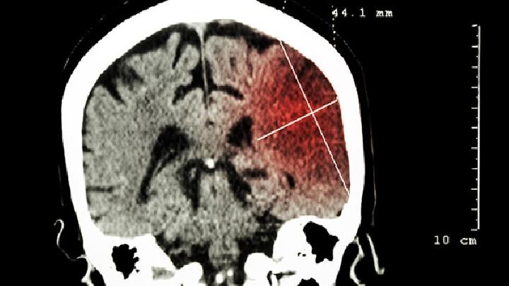 脑部受伤比较可能会引发脑瘫