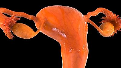 多囊卵巢综合征缠上“90后”女生？