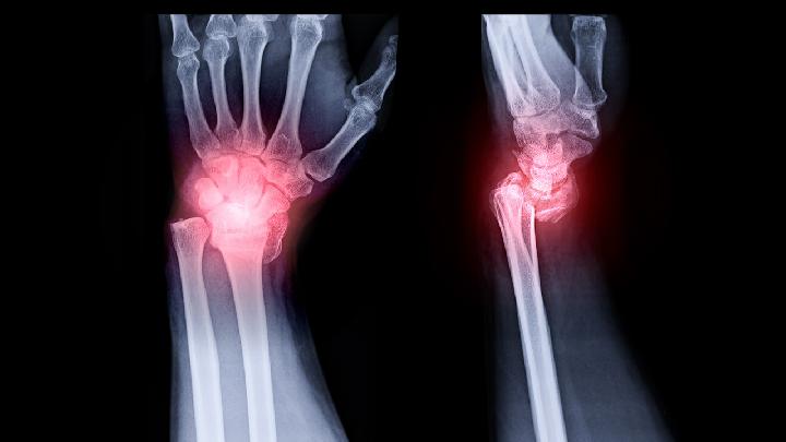 腱鞘炎的原因是由于关节的过度劳损造成的