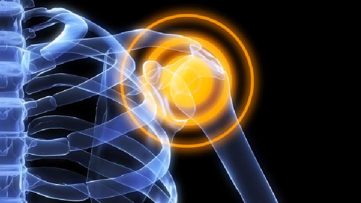 功能性病变是主要的肩周炎的病因