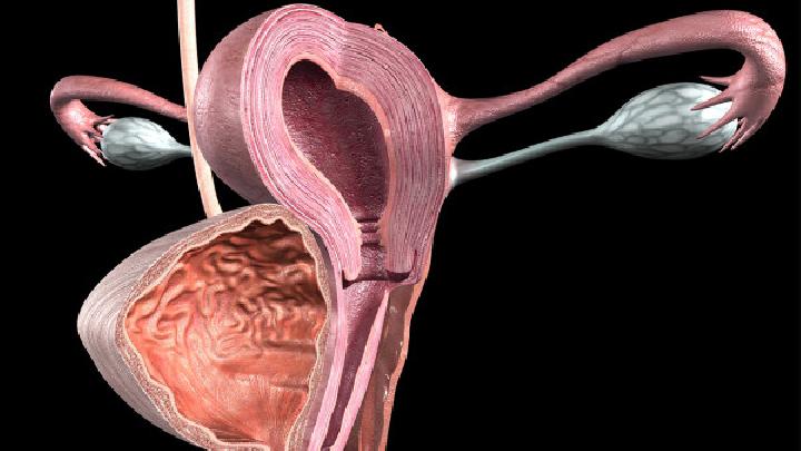 真菌感染很可能引发宫颈癌的病因