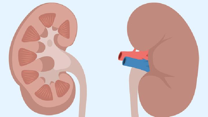 病人肾疼痛不分明易发生多发性肾结石