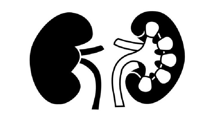 慢性腎炎較明顯的表現(xiàn)就是蛋白尿