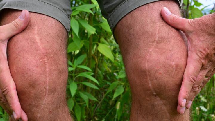 專家講解引發(fā)O型腿的病因