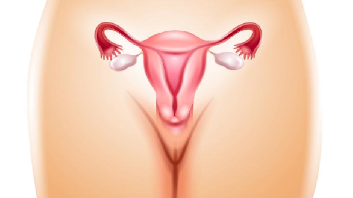 子宫癌基本都可以发现有阴道分泌物