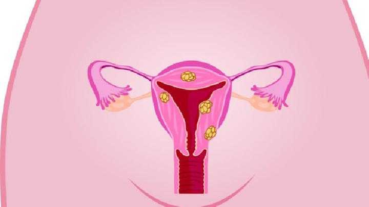 两种有效的卵巢囊肿的食疗方法