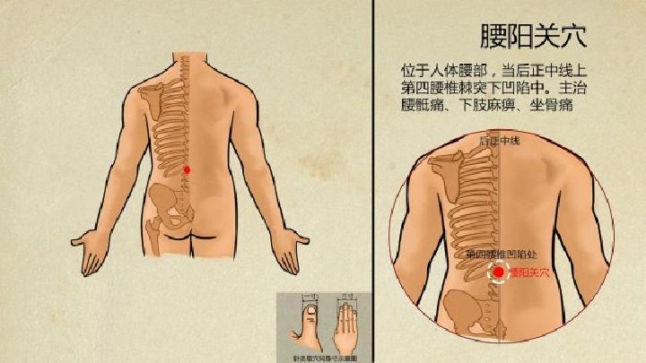 腰肌劳损长期发作的话会导致腰背部酸痛不适