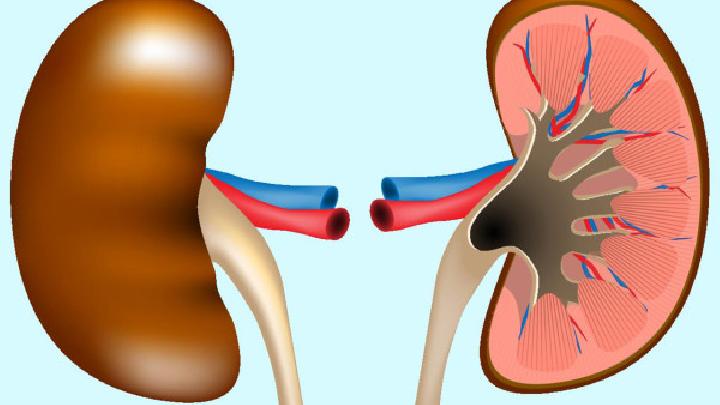 肾结石常见的症状就是腰部和上腹部隐痛
