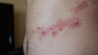 天然水果给你带来意想不到的美容功效