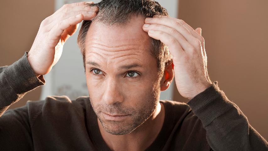 晚期脱发的症状是什么呢?