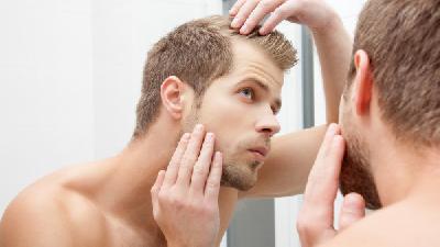 脂溢性脱发主要发生于男性青年