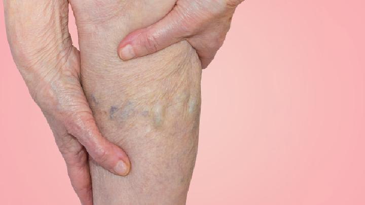 详细介绍O型腿的有效治疗方法