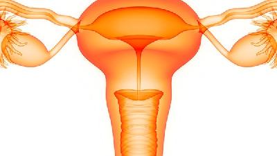 卵巢囊肿手术前需要注意的几点