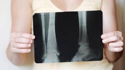 過度過量飲酒導致股骨頭缺血性壞死