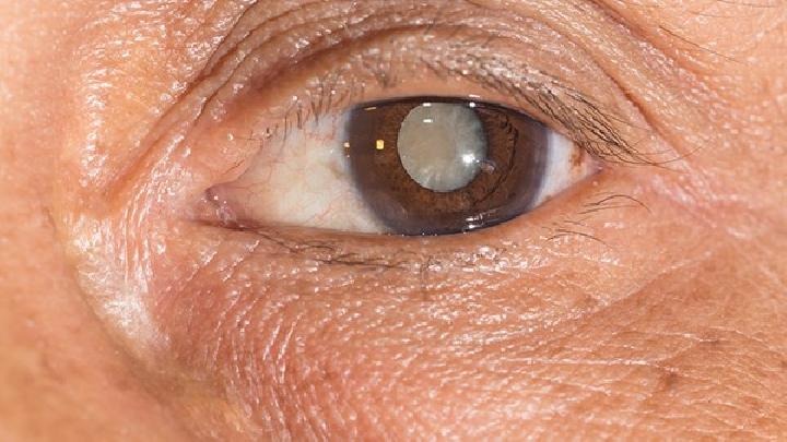 对眼睛的防护能够有效帮助白内障的护理