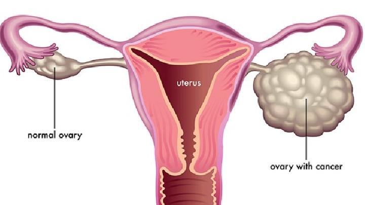 女性们要及早重视盆腔炎的预防工作