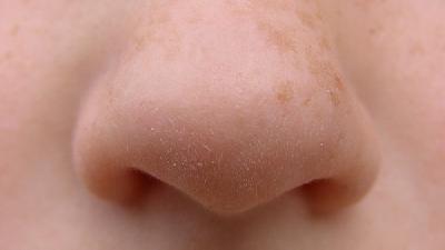 进一步解析关于鼻炎的详细症状