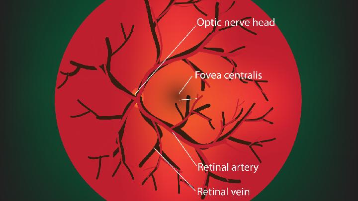 几种比较主要的视网膜疾病的早期症状