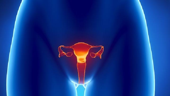 专家解读可能的引起卵巢囊肿的原因