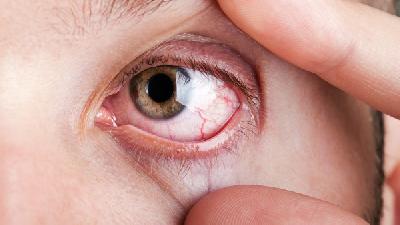 具体的青光眼的危害表现有哪些