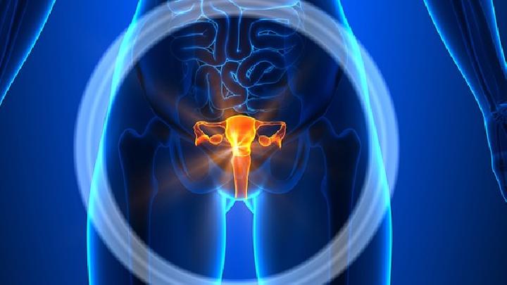 女性卵巢囊肿症状哪些是典型的我们要了解