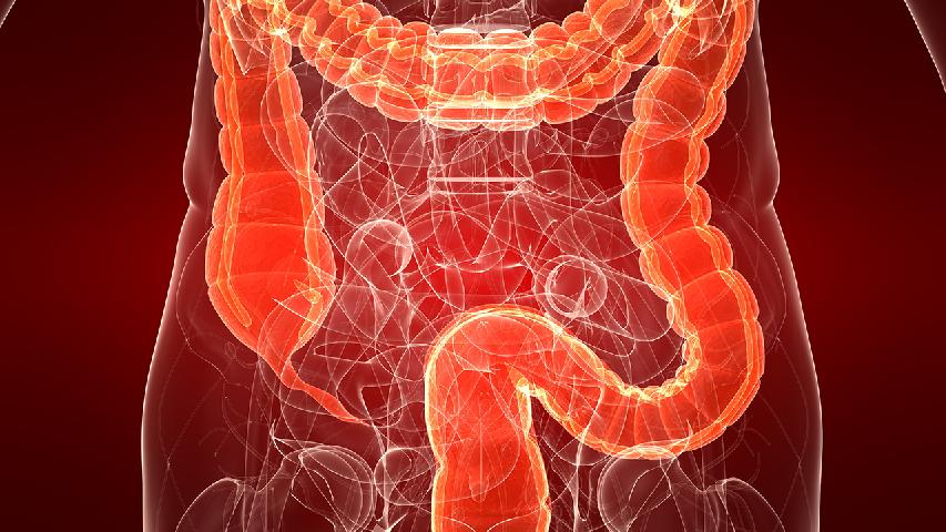 結(jié)腸癌引起急性闌尾炎的6個原因